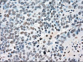 PLK1 / PLK-1 Antibody (clone OTI5C1)