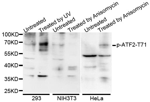 Polyclonal Rabbit anti-Human ATF2 Antibody (phospho-Thr53, IHC, IF, WB)