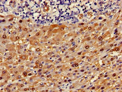ASL / Argininosuccinate Lyase Antibody