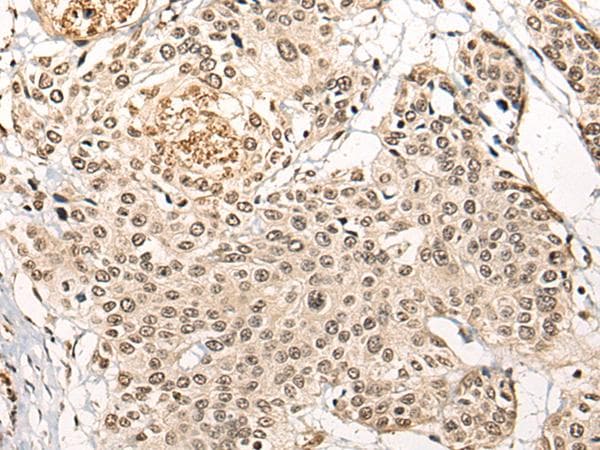 BATF Antibody