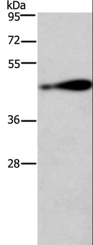 Polyclonal Rabbit anti-Human AGER / RAGE Antibody (IHC, WB)