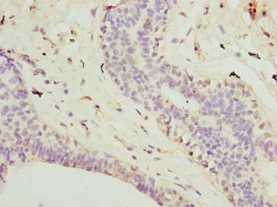 Polyclonal Rabbit anti-Human TMEM161A Antibody (IHC, WB)