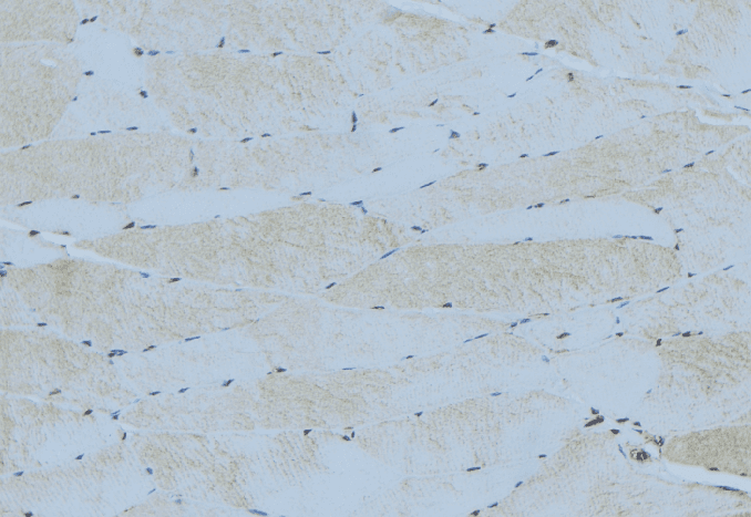SOCS3 Antibody