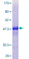 Human TIMP4 Protein (Recombinant GST)