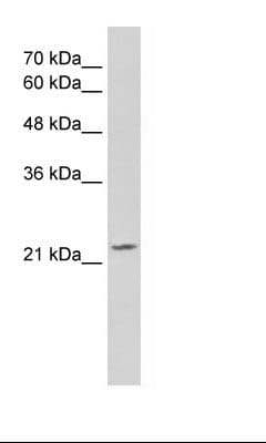 OVOL1 Antibody (C-Terminus, HRP)