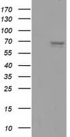 Alpha-Fetoprotein Antibody (clone OTI2A6)
