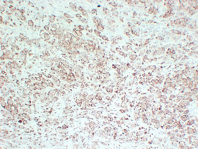 Monoclonal Mouse anti-Human Tyrosinase Antibody (clone ABT-TYR, IHC)