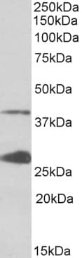 IHC-plus™ UROD Antibody (aa290-304)
