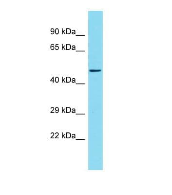 KIF1BP Antibody (aa21-70)