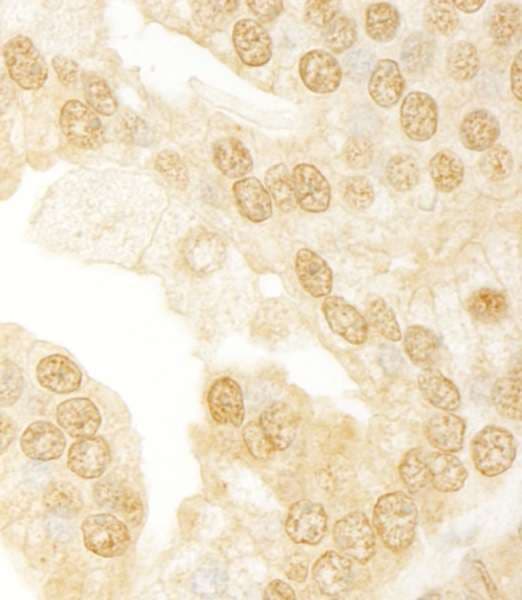 ANKRD17 Antibody (aa1550-1600)
