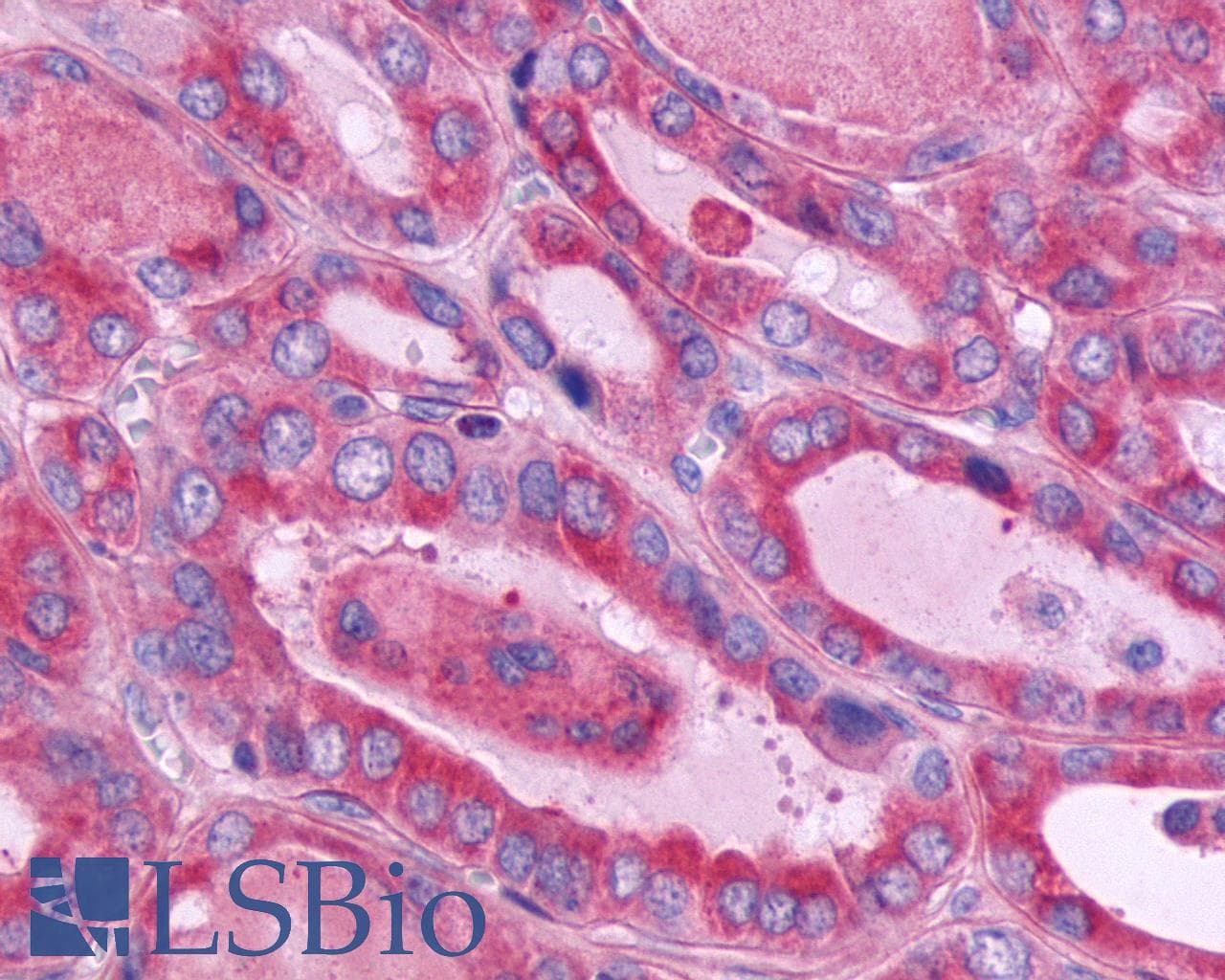 PathPlus™ Polyclonal Rabbit anti-Human ADGRE5 / CD97 Antibody (Cytoplasmic Domain, IHC)