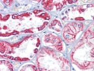 KRT8 / CK8 / Cytokeratin 8 Antibody (aa391-483, clone 8A5D12)