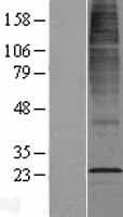 CYB561D2 Protein (Over-Expression Lysate Myc-DDK (Flag))