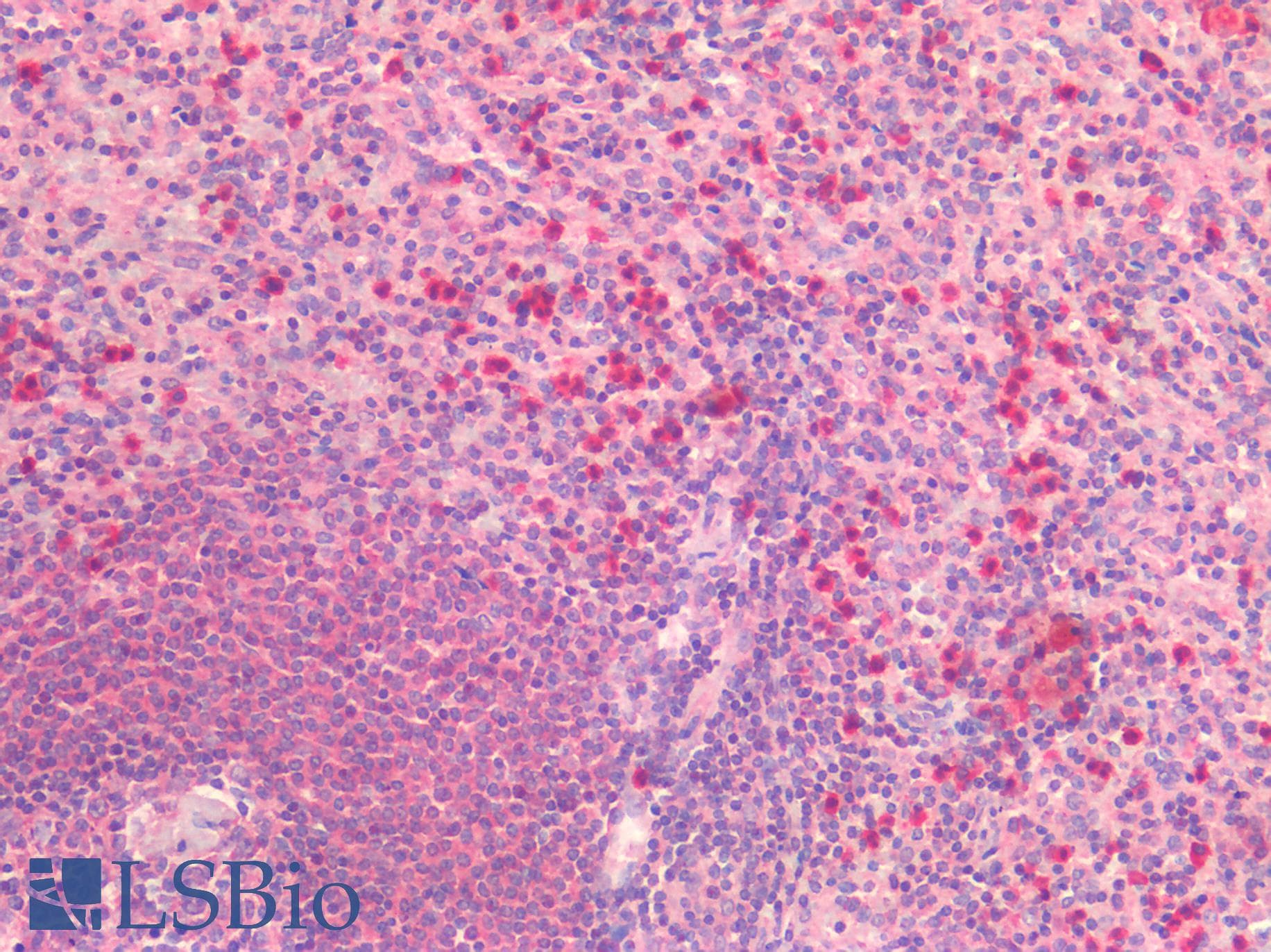IHC-plus™ Polyclonal Rabbit anti-Human IL6 / Interleukin 6 Antibody (IHC)