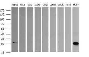 LGALS3 / Galectin 3 Antibody (clone OTI1A2)