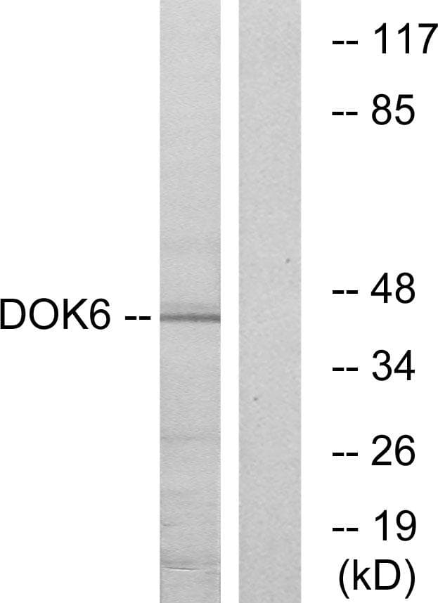 DOK6 Antibody