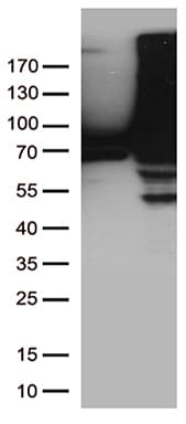 Monoclonal Mouse anti-Human TGM2 / Transglutaminase 2 Antibody (clone OTI1A3, IHC, WB)