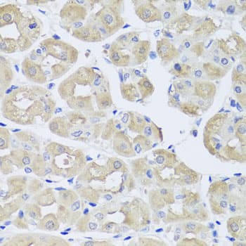 Osteocalcin Antibody (AP)