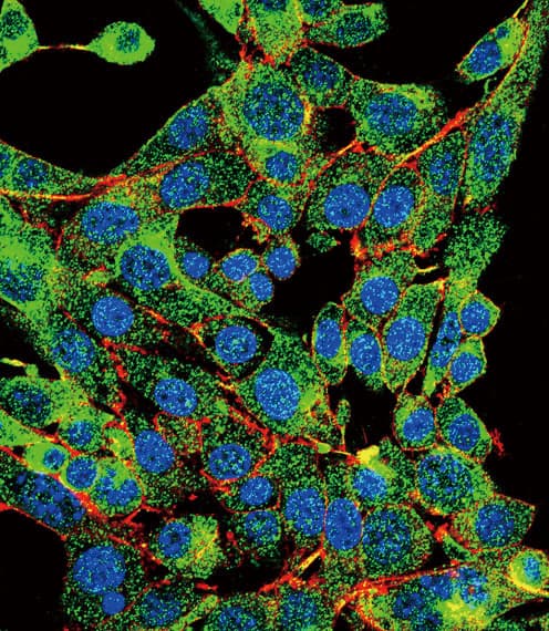 PSMB1 Antibody (aa214-241)