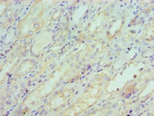 Polyclonal Rabbit anti-Human SERPINA6 / CBG Antibody (aa136-405, IHC)