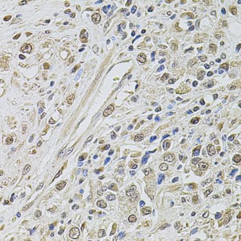 Polyclonal Rabbit anti-Human SMARCC2 Antibody (IHC, WB)