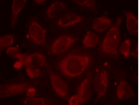 RELA / NFKB p65 Antibody