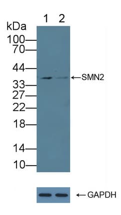 SMN1 Antibody (aa16-251)