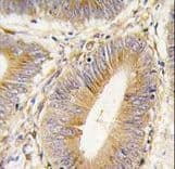 Polyclonal Rabbit anti-Human AKR1B1 / Aldose Reductase Antibody (aa102-135, IHC, IF, WB)