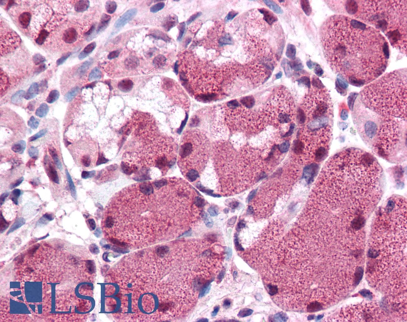 IHC-plus™ Polyclonal Rabbit anti-Human KIAA0152 / MLEC Antibody (Internal, IHC)
