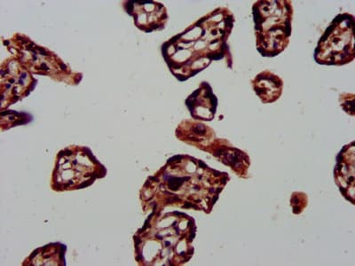DNAJA1 / HDJ2 Antibody