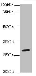 Polyclonal Rabbit anti-Human TBC1D26 Antibody (WB)