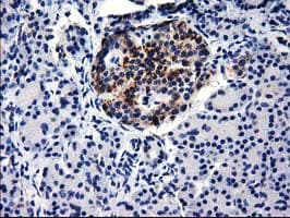 GGPS1 Antibody (clone OTI3F9)