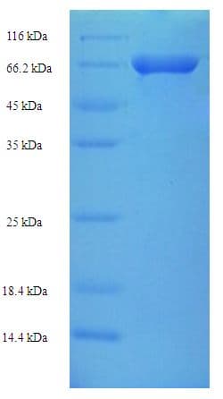 Human VIPAS39 Protein (Recombinant His-SUMO)
