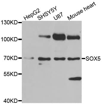 Polyclonal Rabbit anti-Human SOX5 Antibody (aa1-120, IHC, IF, WB)