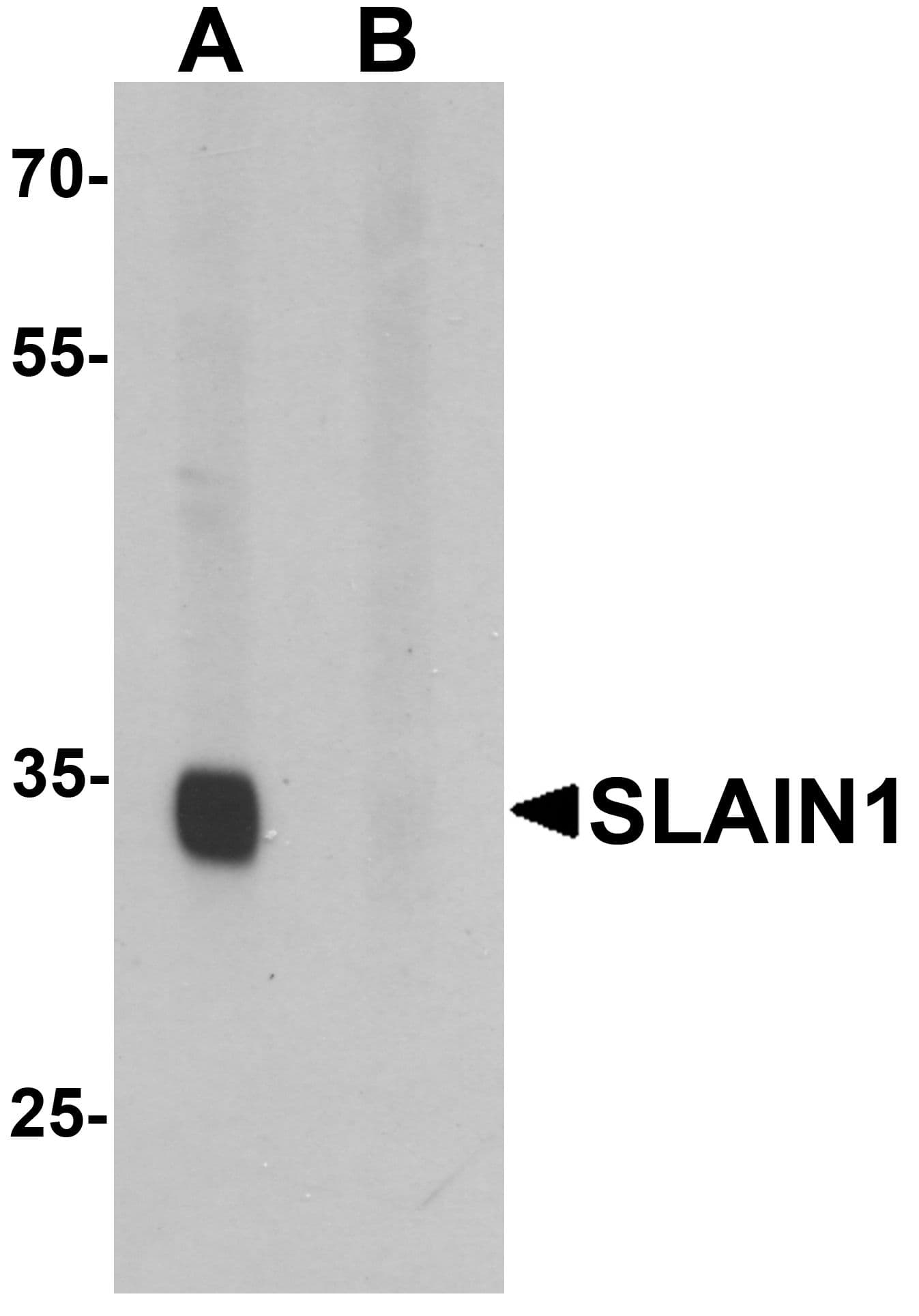 IHC-plus™ SLAIN1 Antibody