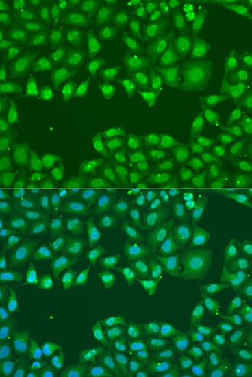 SSB / La Antibody