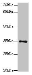MED27 / CRSP8 Antibody