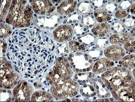 CMPK / CMPK1 Antibody (clone OTI1A1)