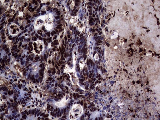 TALDO1 / Transaldolase 1 Antibody (clone OTI2E4)