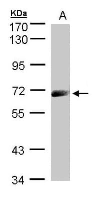 IL12RB1 / CD212 Antibody (aa57-488)