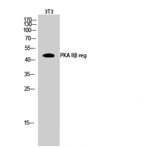 PRKAR2B Antibody (50-130 aa)