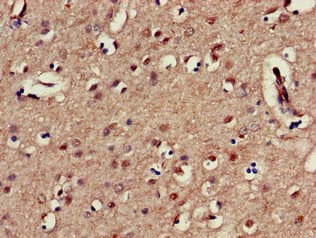 KIR3DL1 Antibody