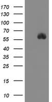 SPINT1 / HAI-1 Antibody (clone OTI1D2)