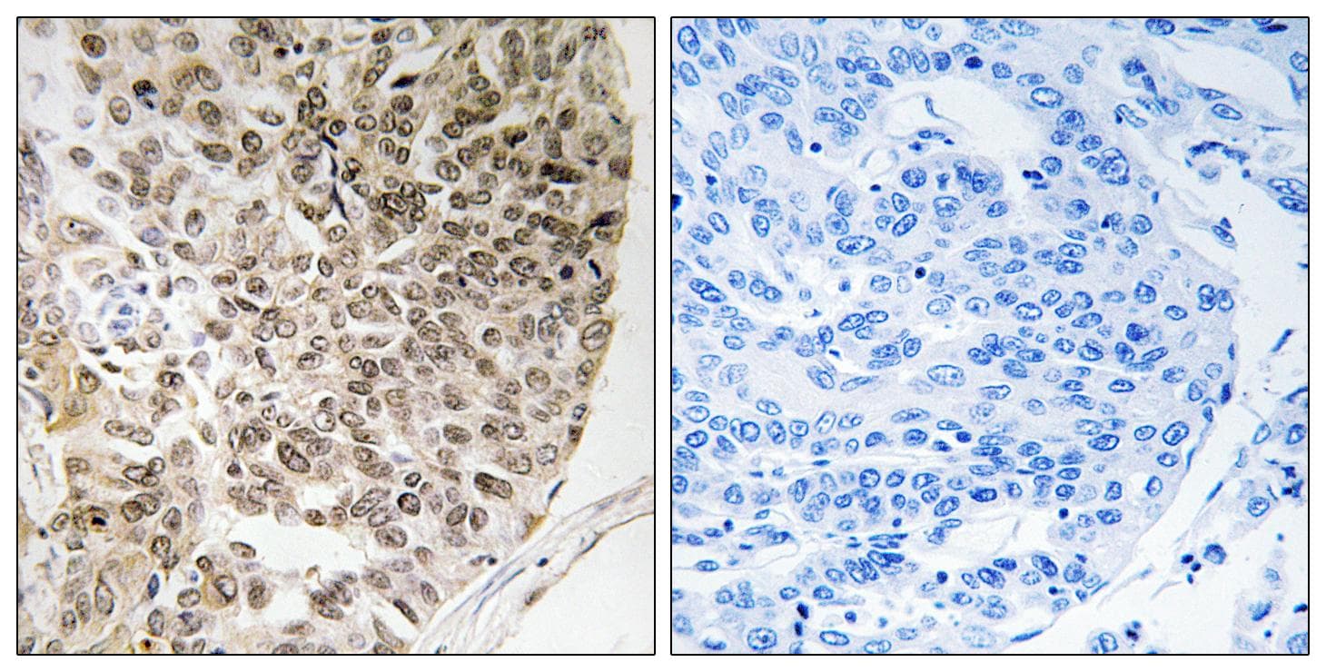 CALD1 / Caldesmon Antibody (phospho-Ser759)