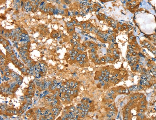 PYGL Antibody