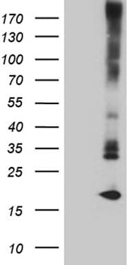 MGP / Matrix Gla-Protein Antibody (clone OTI11D9)