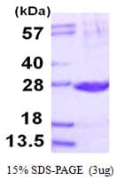 Human PSMB2 Protein (Recombinant His)
