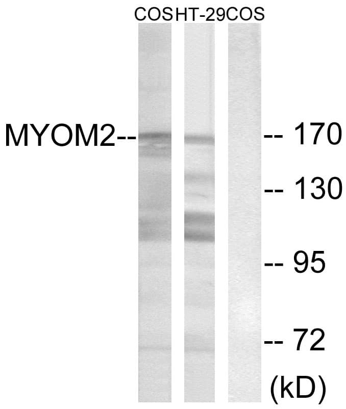 IHC-plus™ MYOM2 / Myomesin 2 Antibody (aa612-661)