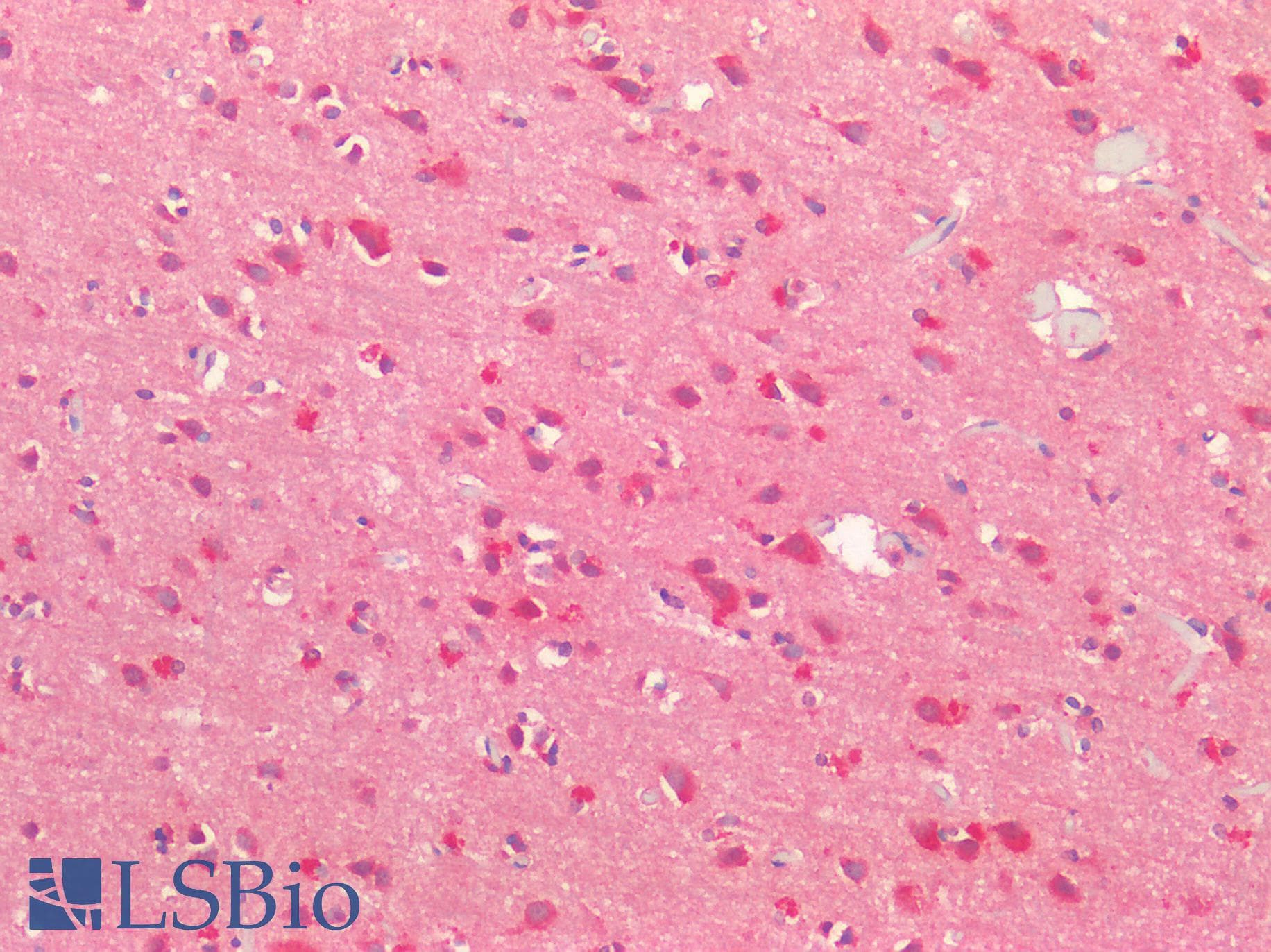 IHC-plus™ Polyclonal Rabbit anti-Human MAP2 Antibody (IHC)