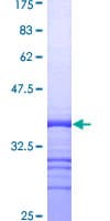 Human CD9 Protein (Recombinant GST, N-terminus)